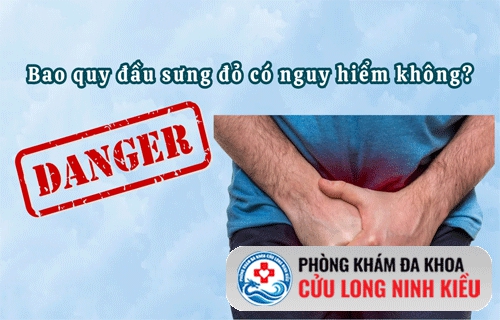 dương vật, bao quy đầu bị sưng có nguy hiểm không?