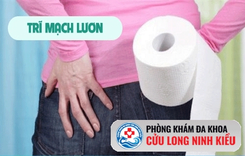 Bệnh mạch lươn là gì ? có nguy hiểm không?