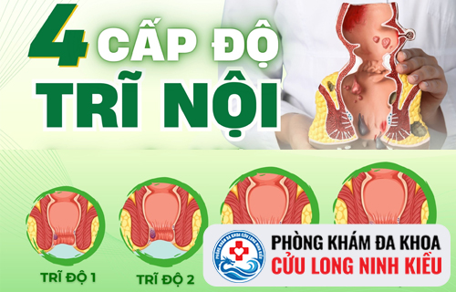 Dấu hiệu trĩ nội không nên coi thường