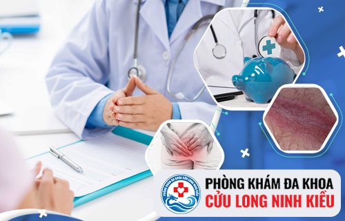 Chi phí hỗ trợ điều trị chàm hậu môn mất bao nhiêu?