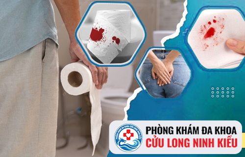 Đại tiện ra máu - bệnh lý nguy hiểm không nên coi thường