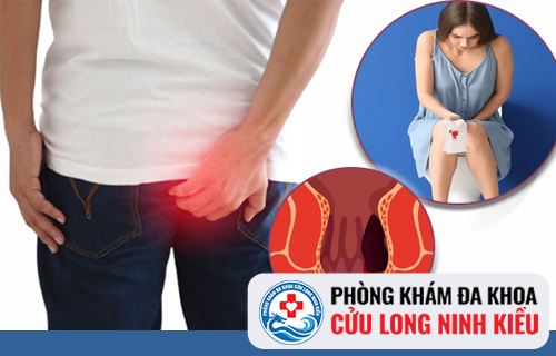 Đi cầu đau rát là biểu hiện của bệnh gì?