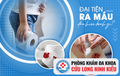 Đại tiện đau rát là bệnh lý gì?