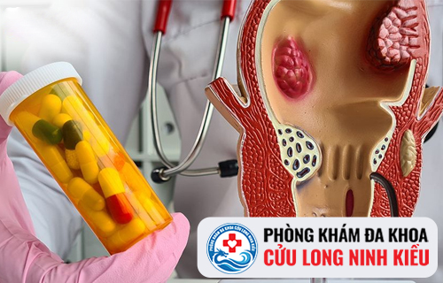 Chi phí điều trị hẹp hậu môn có tốn kém không?