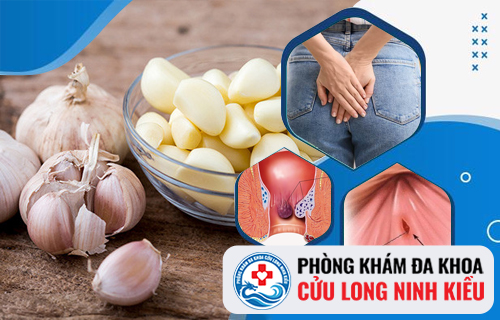 Mẹo hỗ trợ chữa ngứa hậu môn bằng tỏi có hiệu quả?