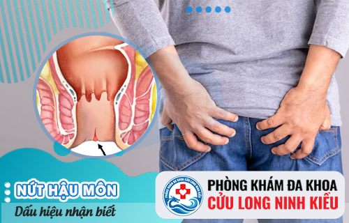Nứt hậu môn là căn bệnh như thế nào?