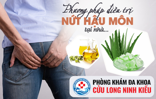 Chữa nứt hậu môn tại nhà có nên không?