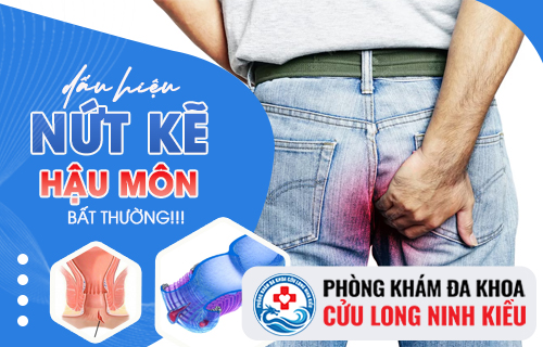 Sơ lược về bệnh nứt kẽ hậu môn