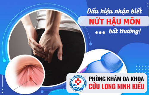 Những dấu hiệu nứt hậu môn không nên xem thường