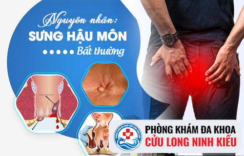 Tình trạng sưng hậu môn cảnh báo điều gì?