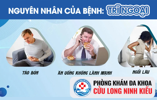 Nguyên Nhân Bệnh Trĩ Ngoại Và Biểu Hiện Đáng Chú Ý