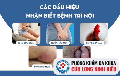 Trĩ nội là gì? Trĩ nội có nguy hiểm không?