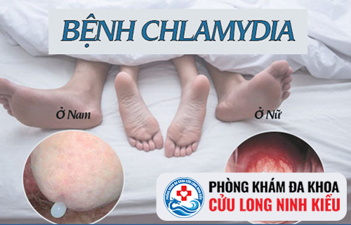 Giải đáp những thắc mắc về bệnh Chlamydia