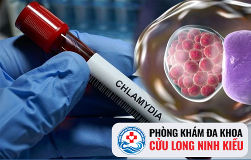 Dấu hiệu nhiễm nấm Chlamydia - Cách chữa trị ra sao?