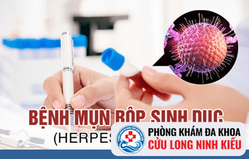 Mụn rộp sinh dục có tái phát không?