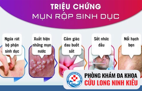 Triệu chứng nhận biết bệnh mụn rộp sinh dục