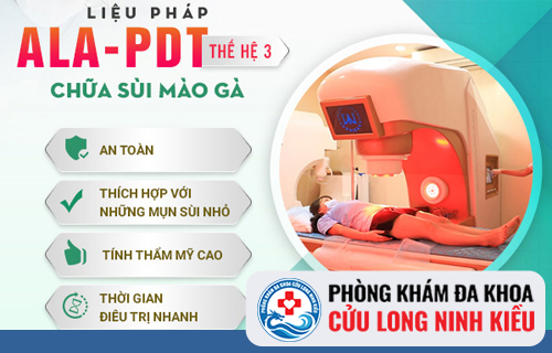 Cách hỗ trợ chữa sùi mào gà hiệu quả tối ưu