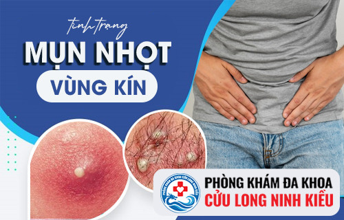 Mụn nhọt ở vùng kín cảnh báo nguy hiểm khôn lường