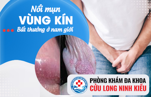 Cảnh báo nổi mụn vùng kín bất thường ở nam giới