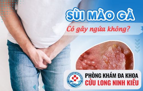 Sùi mào gà có ngứa không?