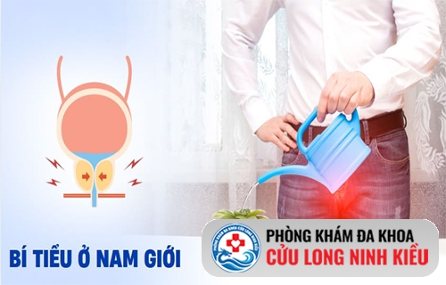 Bí tiểu ở nam – Tình trạng khó nói nhưng cần xử lý sớm