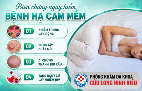 Sự thật kinh hoàng về bệnh hạ cam và những biến chứng khôn lường