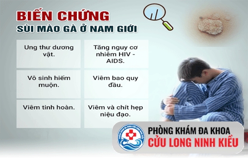Bệnh sùi mào gà ở nam giới, càng tiến triển càng nguy hiểm