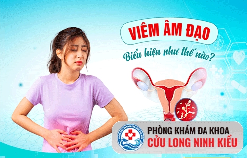 Dấu hiệu nhận biết viêm âm đạo ở nữ giới là gì?