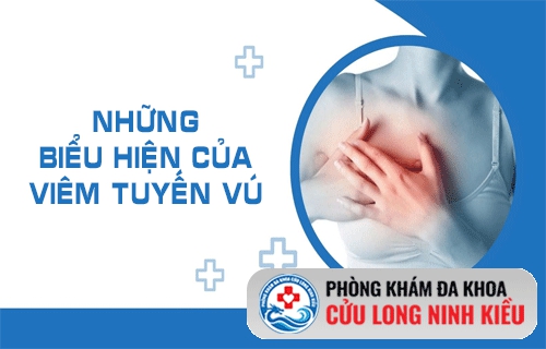 Biểu hiện của viêm tuyến vú