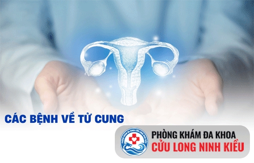 Tử cung bất thường - nguyên nhân gây vô sinh chính ở nữ giới