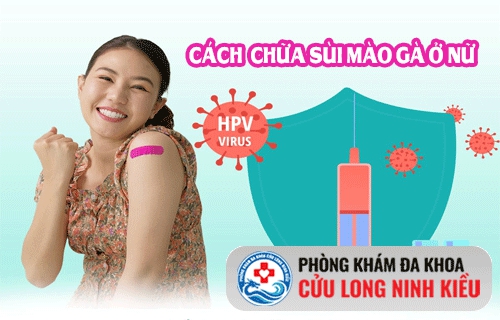 Chữa sùi mào gà ở nữ giới