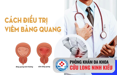 Chữa trị viêm bàng quang như thể nào?
