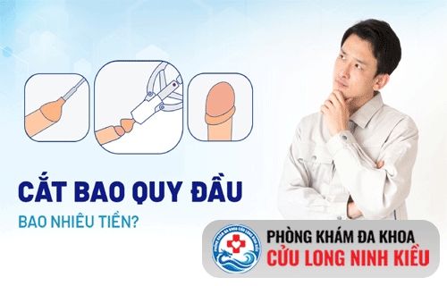 Chi phí tiểu phẫu cắt bao quy đầu