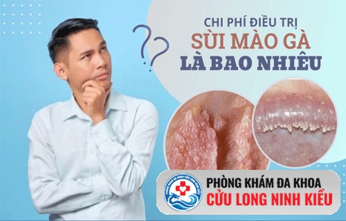 Chi Phí Hỗ Trợ Điều Trị ALA PDT Khoảng Bao Nhiêu ?