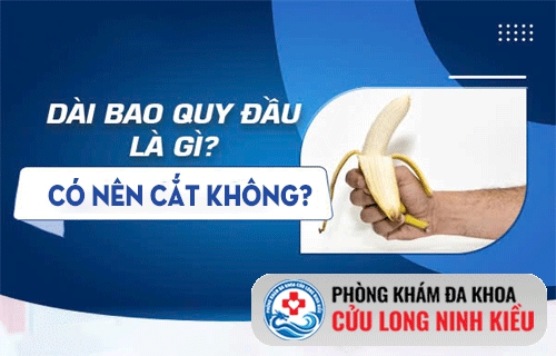 Bị dài bao quy đầu có nên cắt không?
