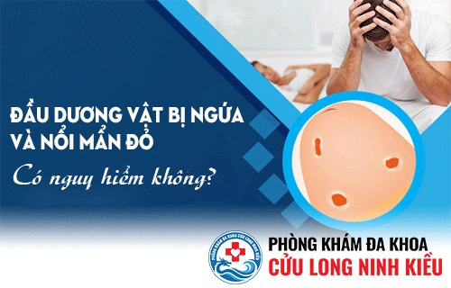 Đầu dương vật bị ngứa và mẩn đỏ là bị gì và có sao không ?