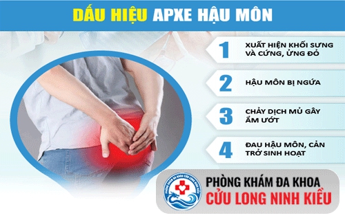 Các dấu hiệu của bệnh áp xe hậu môn