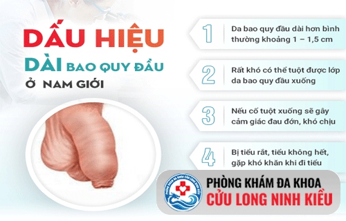 Dài bao quy đầu và phương pháp chữa dài bao quy đầu