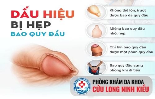 Dấu hiệu và biểu hiện của hẹp bao quy đầu