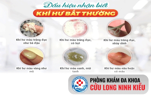 Dấu hiệu nhận biết của bệnh khí hư bất thường