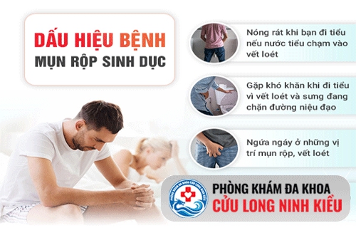 Triệu chứng của bệnh mụn rộp sinh dục