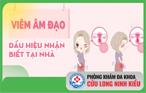6 Cách nhận biết bệnh viêm âm đạo tại nhà