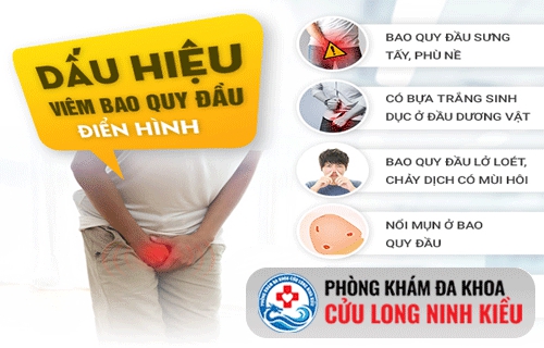 Tìm hiểu về hiện tượng viêm bao quy đầu