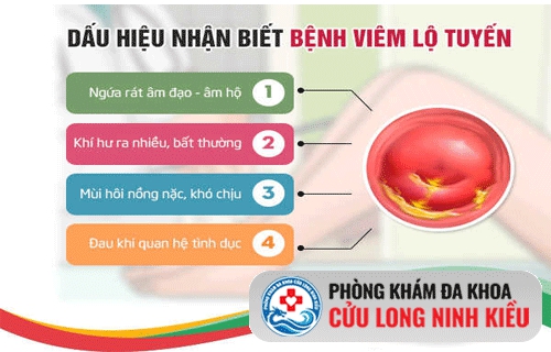 Làm sao để nhận biết viêm lộ tuyến cổ tử cung