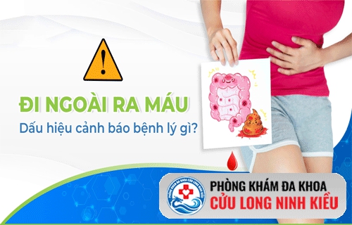 Đi ngoài ra máu là bệnh gì?