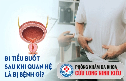 Đi tiểu buốt sau khi quan hệ ở nam giới là bị bệnh gì ?