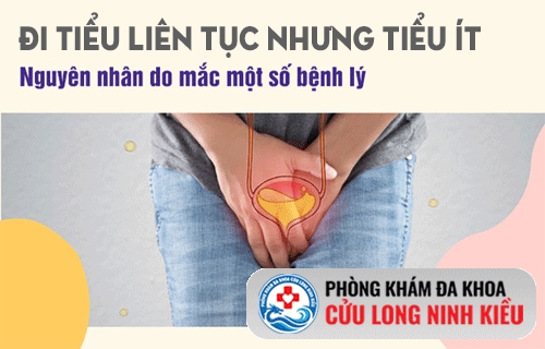Đi tiểu liên tục nhưng tiểu ít ở nam giới là bệnh gì?
