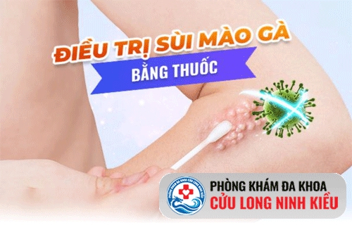 Hỗ trợ chữa sùi mào gà bằng thuốc nào?