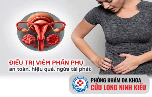 Cập nhật cách Điều trị viêm phần phụ tốt nhất