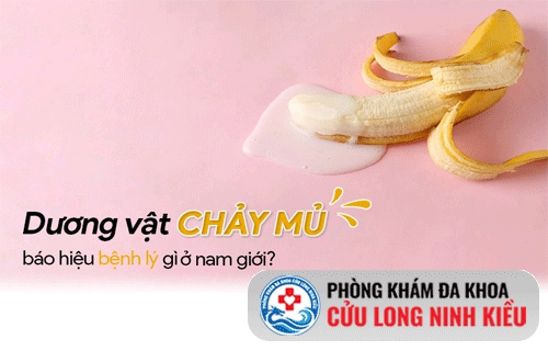 dương vật chảy mủ- dấu hiệu bệnh Lậu ở nam giới